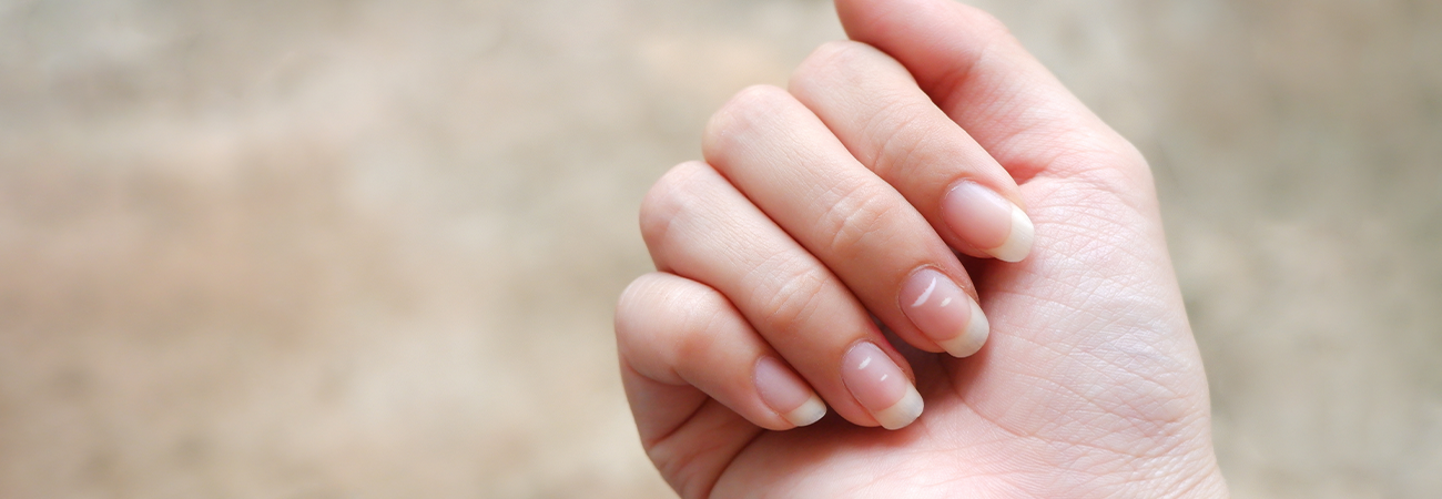 Witte vlekken op nagels: oorzaken, behandeling en preventie