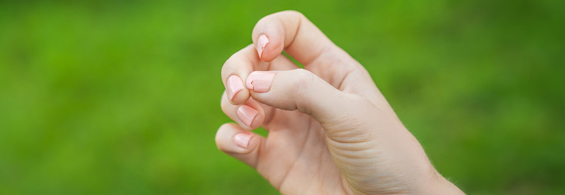 Gespleten Nagels: Oorzaken, Preventie, en Behandeling